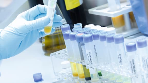 A hand wearing a disposable glove performs quality checks on food in the laboratory. The close-up shows different samples.