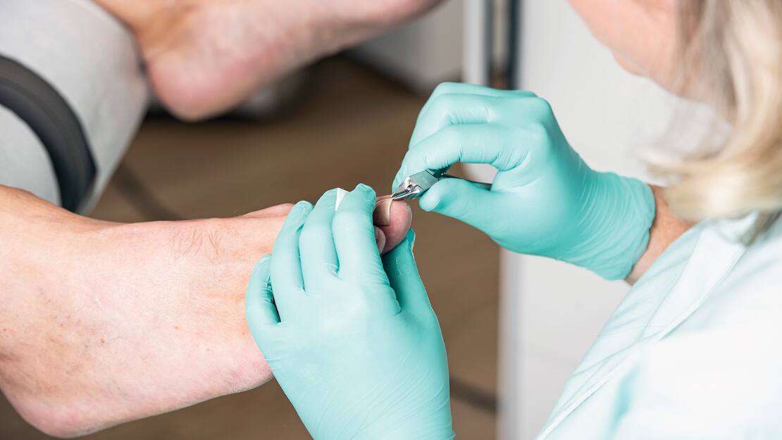 En kvinna med handskar utför en podiatrisk behandling på en fot.