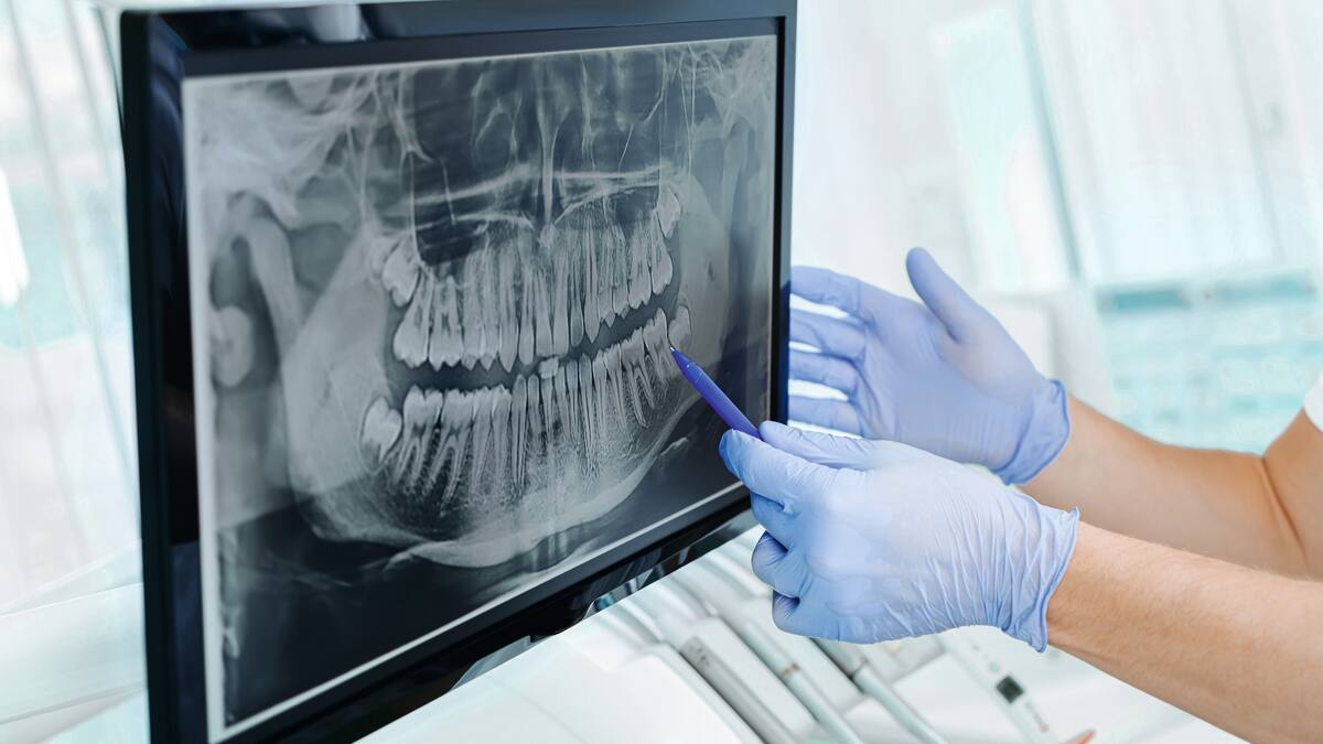 Hände eines Zahnarzts in Handschuhen zeigen die Zähne auf Röntgenbild auf digitalem Bildschirm in Zahnklinik