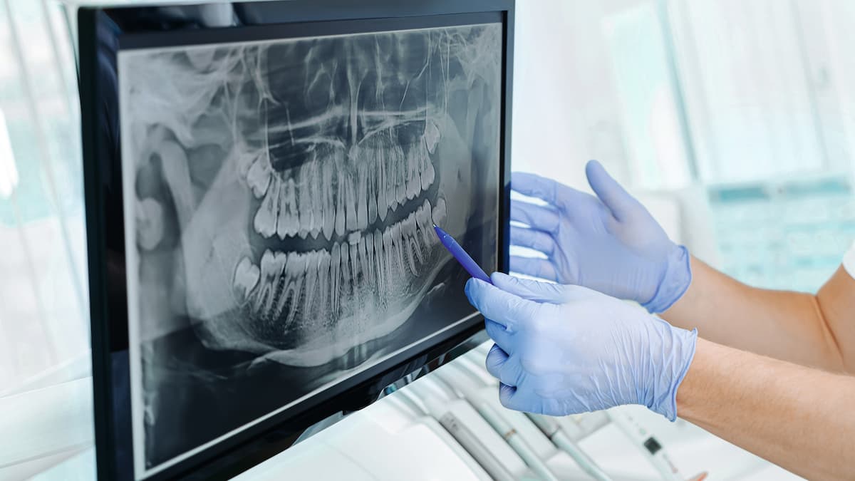 Hands od a dentist in gloves show the teeth on x-ray on digital screen in dental clinic